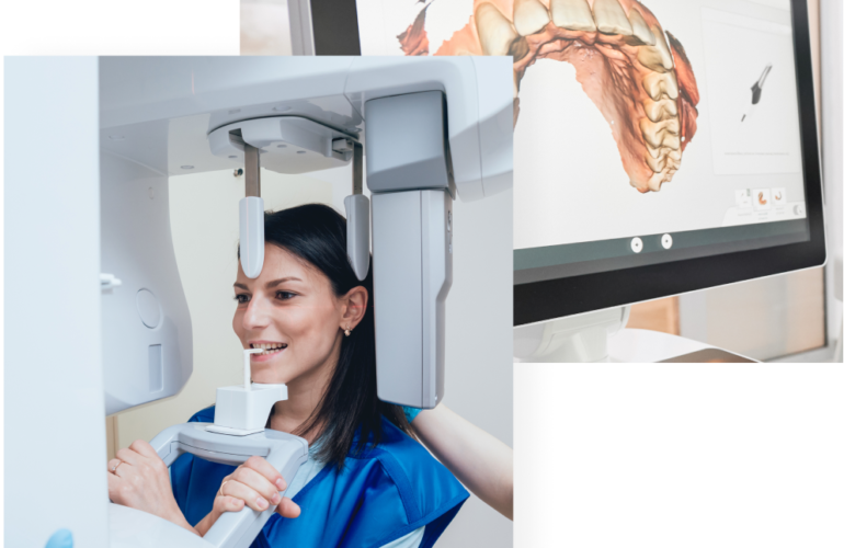 cbct